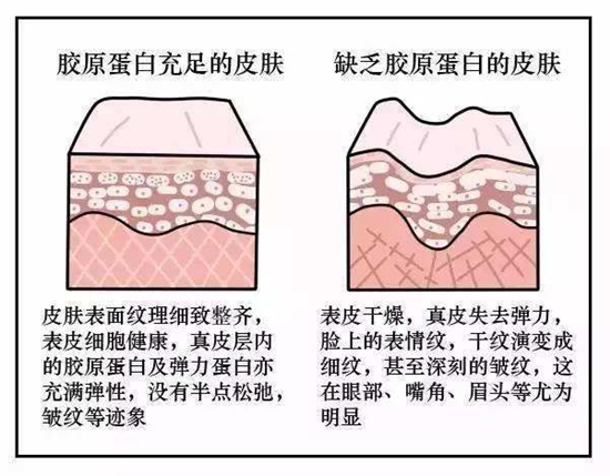 每10年就少1000克！补充胶原蛋白到底有没有用？皮肤科医生给出了一个答案！ 