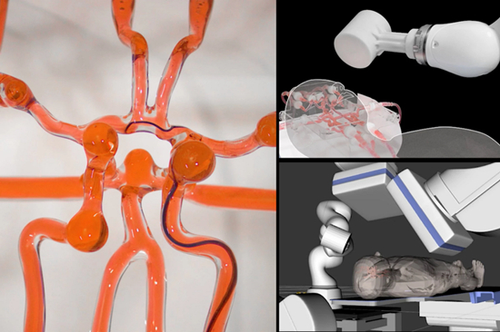 MIT新型手術機器人讓外科醫生可以對中風患者進行遠程手術